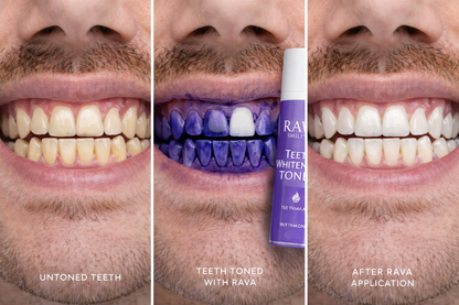 Teeth Whitening Toner