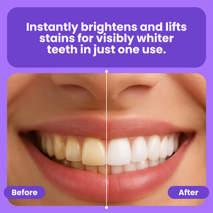 Teeth Whitening Powder