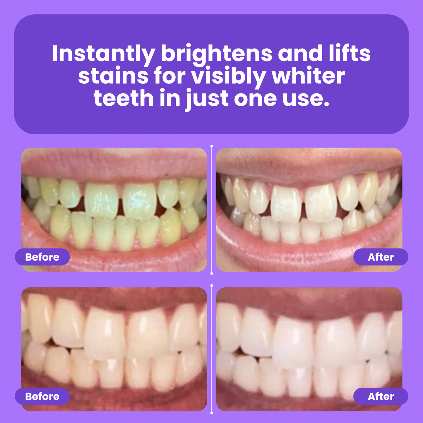 Teeth Whitening Powder