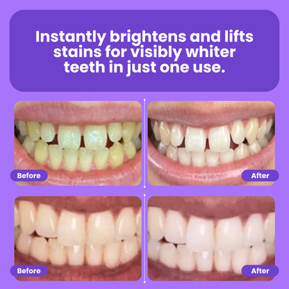 Teeth Whitening Powder